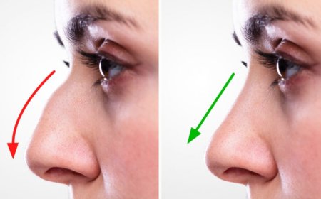 Your Guide to the Best Rhinoplasty in Islamabad: What to Know Before You Book