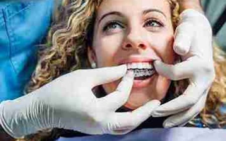 Wearing Aligners at the Beach? Don’t Miss These Points