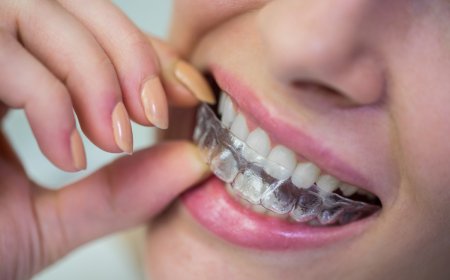 Invisalign Dubai: The Clear Path to a Confident, Straighter Smile