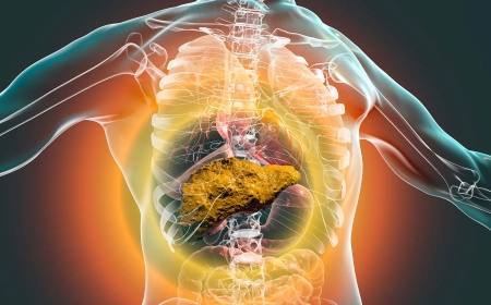 What Is Liver Cirrhosis? Causes, Stages, and Treatment Options