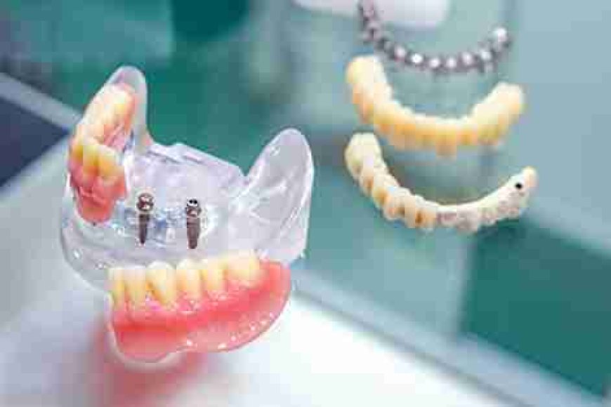 Image Source - Private Dentist Fulham